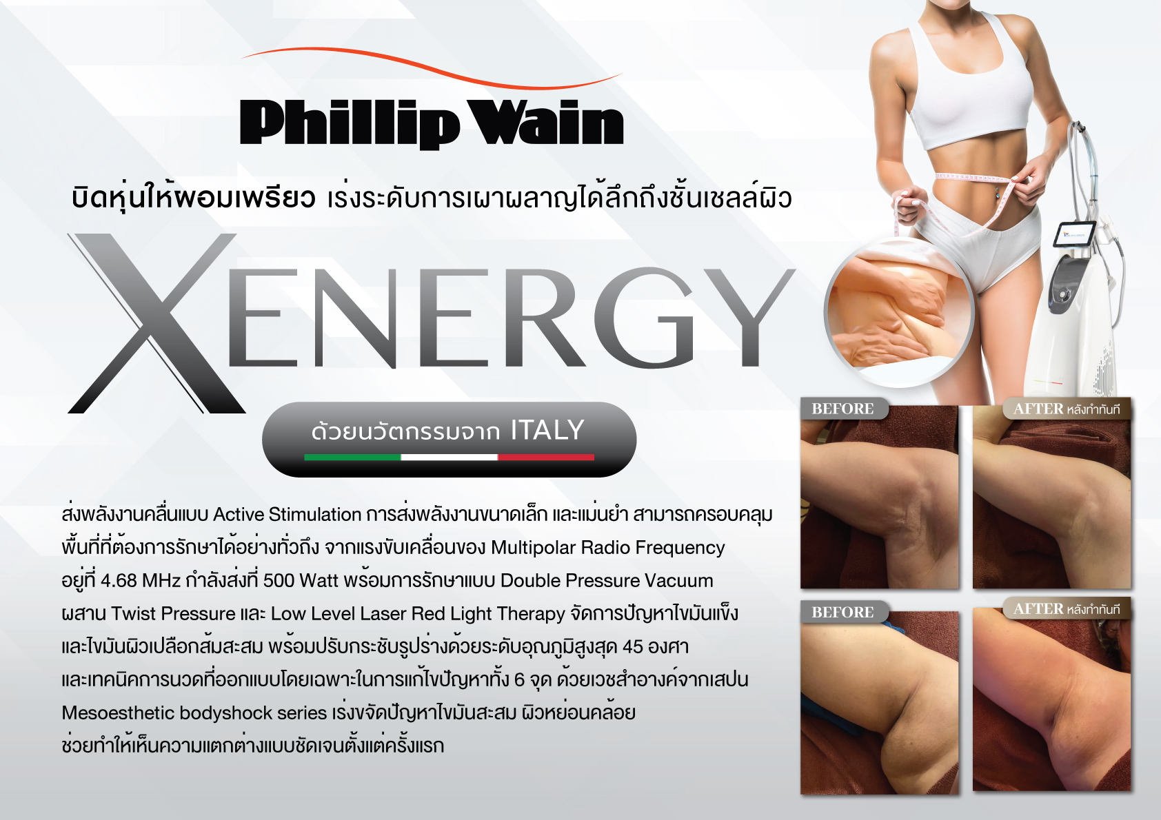 X-Energy-sale-kit-1